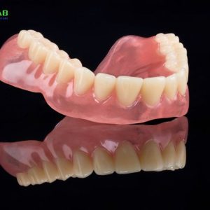 xdent-lab-full-removable-denture